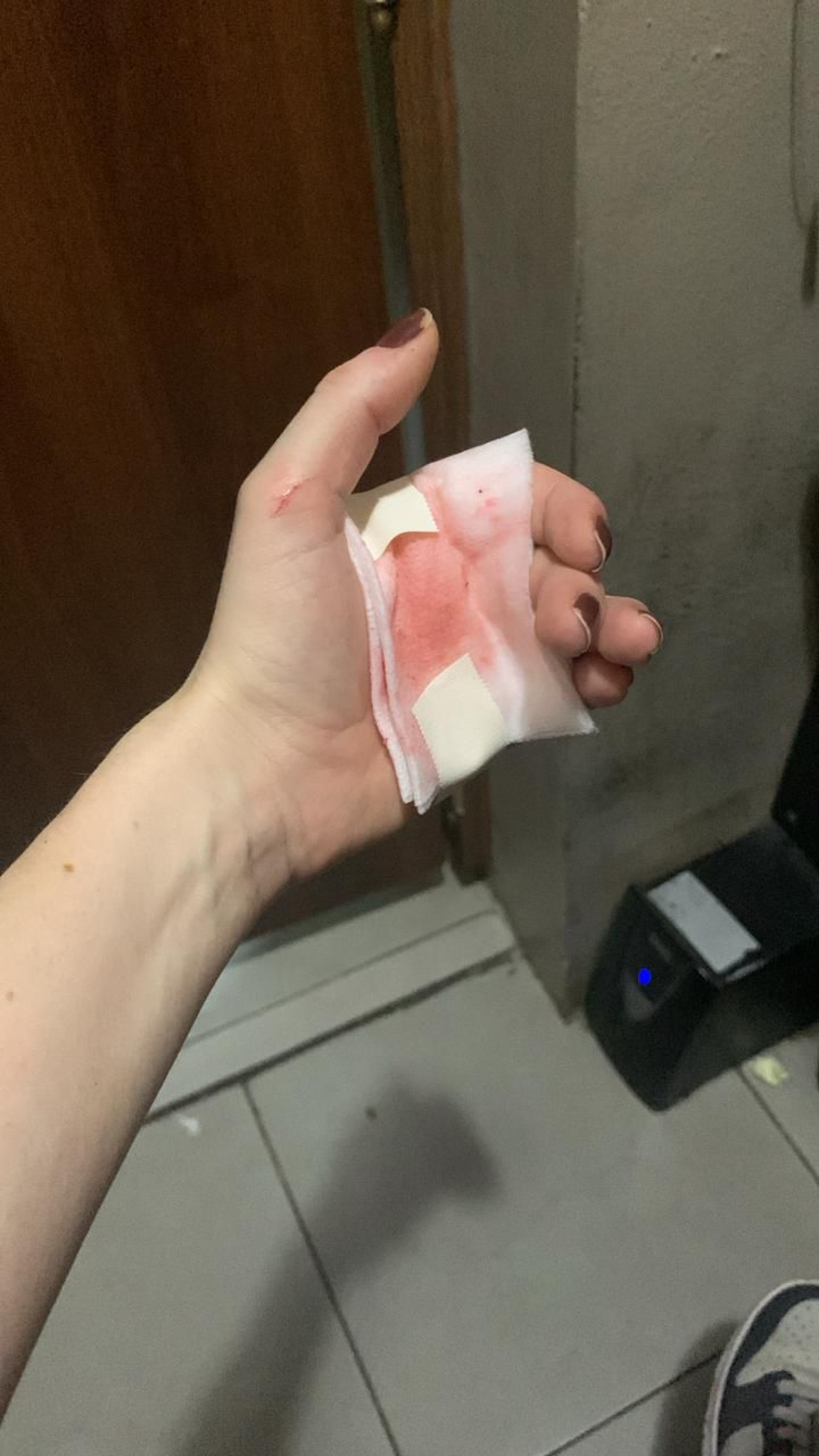 V&iacute;tima foi esfaqueada na m&atilde;o pela dupla em janeiro de 2026 - Divulga&ccedil;&atilde;o / PMERJ