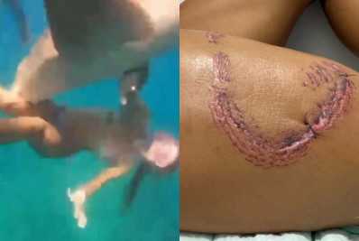 Vídeo mostra momento em que turista é mordida por tubarão em Noronha