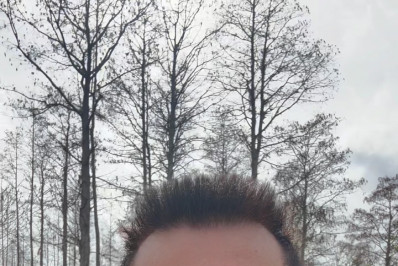 Regis Danese perde dente durante viagem a Orlando