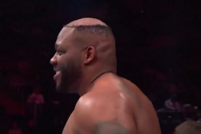 Boxeador que viralizou ao perder peruca durante luta revela quanto gastou no implante