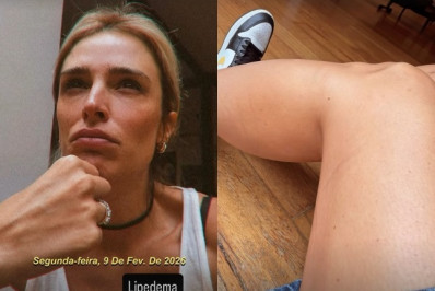 Rafa Brites revela diagnóstico de lipedema