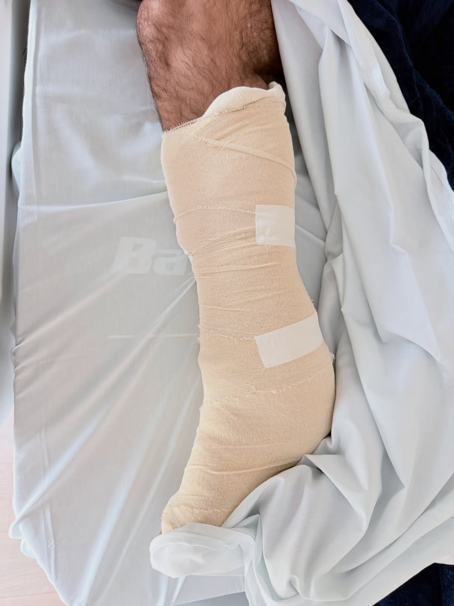 Felipe Simas exibiu a perna enfaixada após cirurgia  - Reprodução/Instagram 