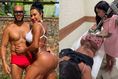 Gracyanne inicia remoção de tatuagem íntima em homenagem a Belo