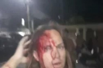 Suposta transa gera agressão à coordenadora LGBTQIA+ em São Pedro da Aldeia