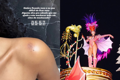 Lorena Maria pede ajuda com hematomas antes do Desfile das Campeãs