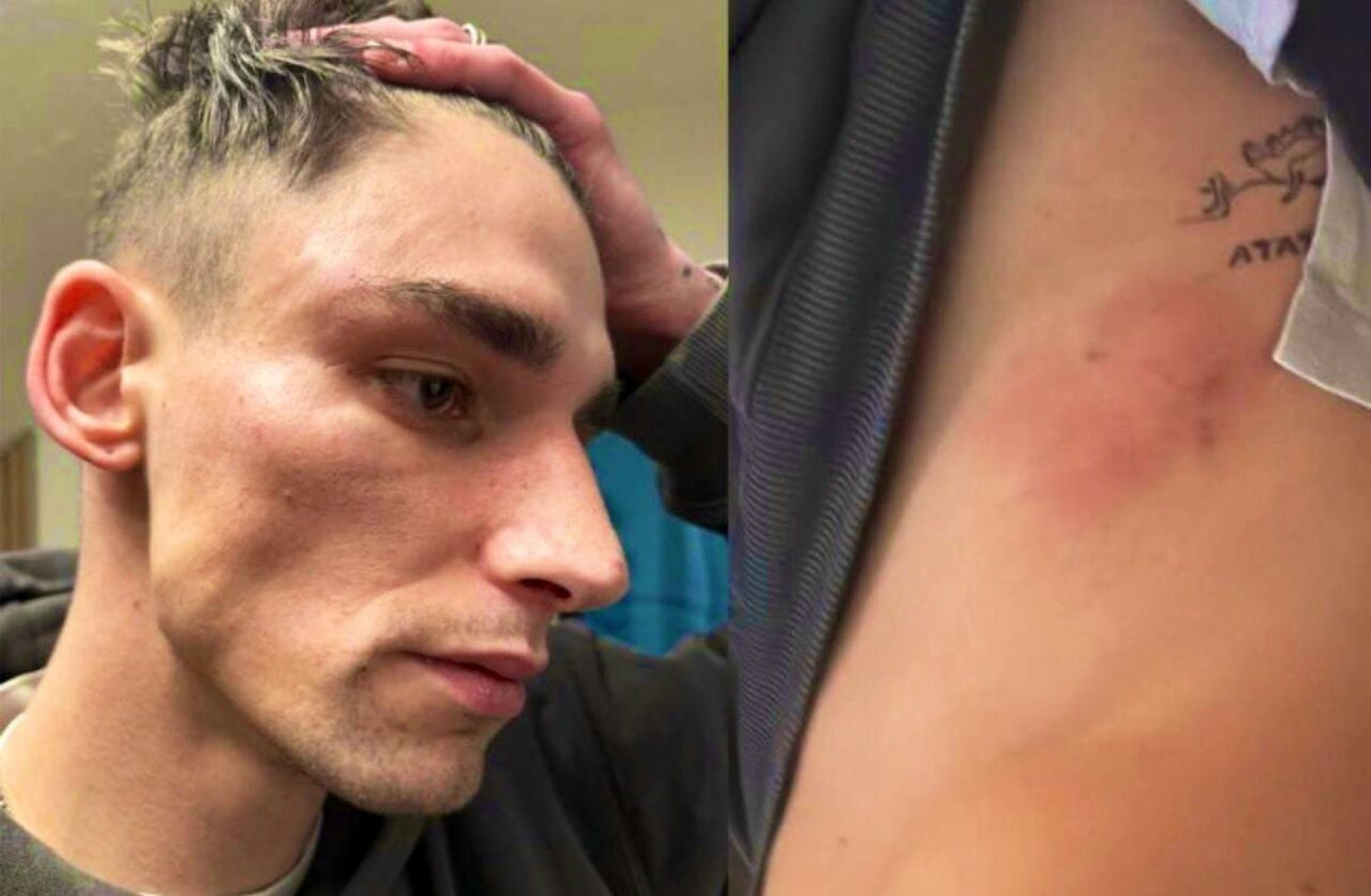 Depois de viralizar, &aacute;rbitro sofre acusa&ccedil;&atilde;o de inventar ser v&iacute;tima de ataque homof&oacute;bico