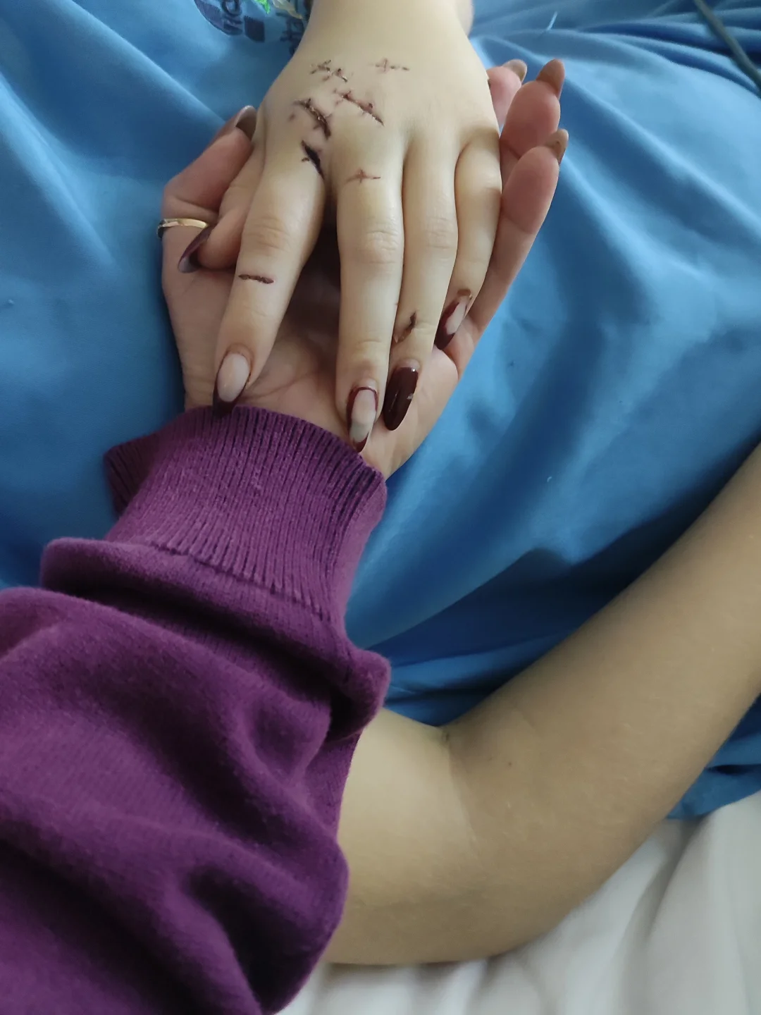 Jovem vítima de tentativa de feminicídio em São Gonçalo passa a respirar sem aparelhos, diz mãe