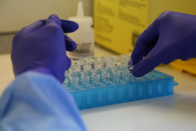 Estado do Rio tem 11 casos de Mpox confirmados em 2026, afirma secretaria