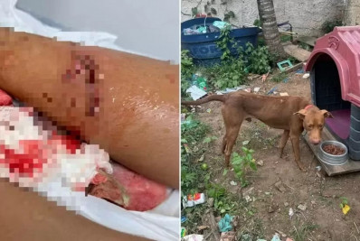 Criança de 7 anos é mordida por cachorro que escapou de casa em Arraial do Cabo