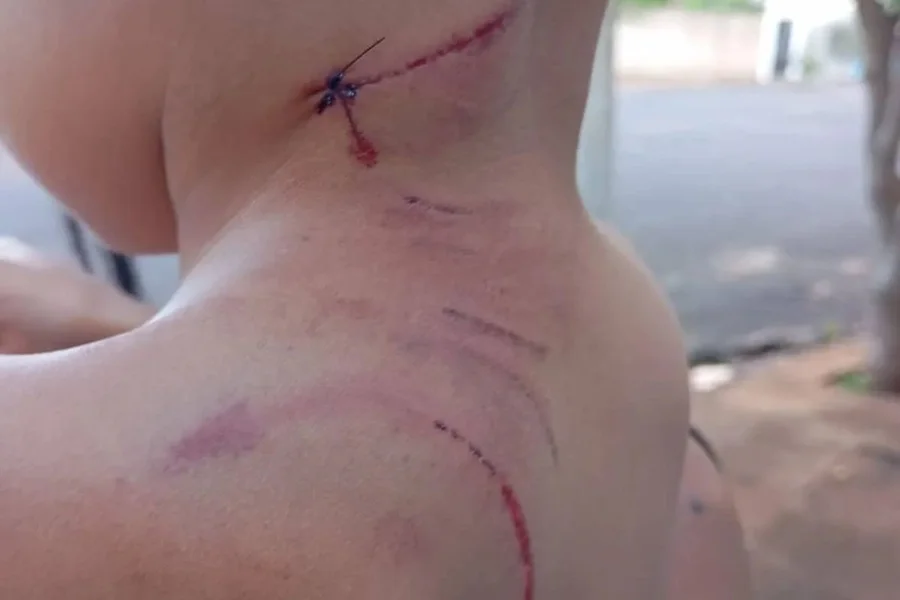 Cão labrador ataca menino de 3 anos e mãe grávida no interior de SP