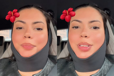 Ex-BBB Fernanda Bande revela novo procedimento estético no rosto