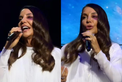 Com olho roxo, Ivete Sangalo sobe ao palco em São Paulo dias após internação