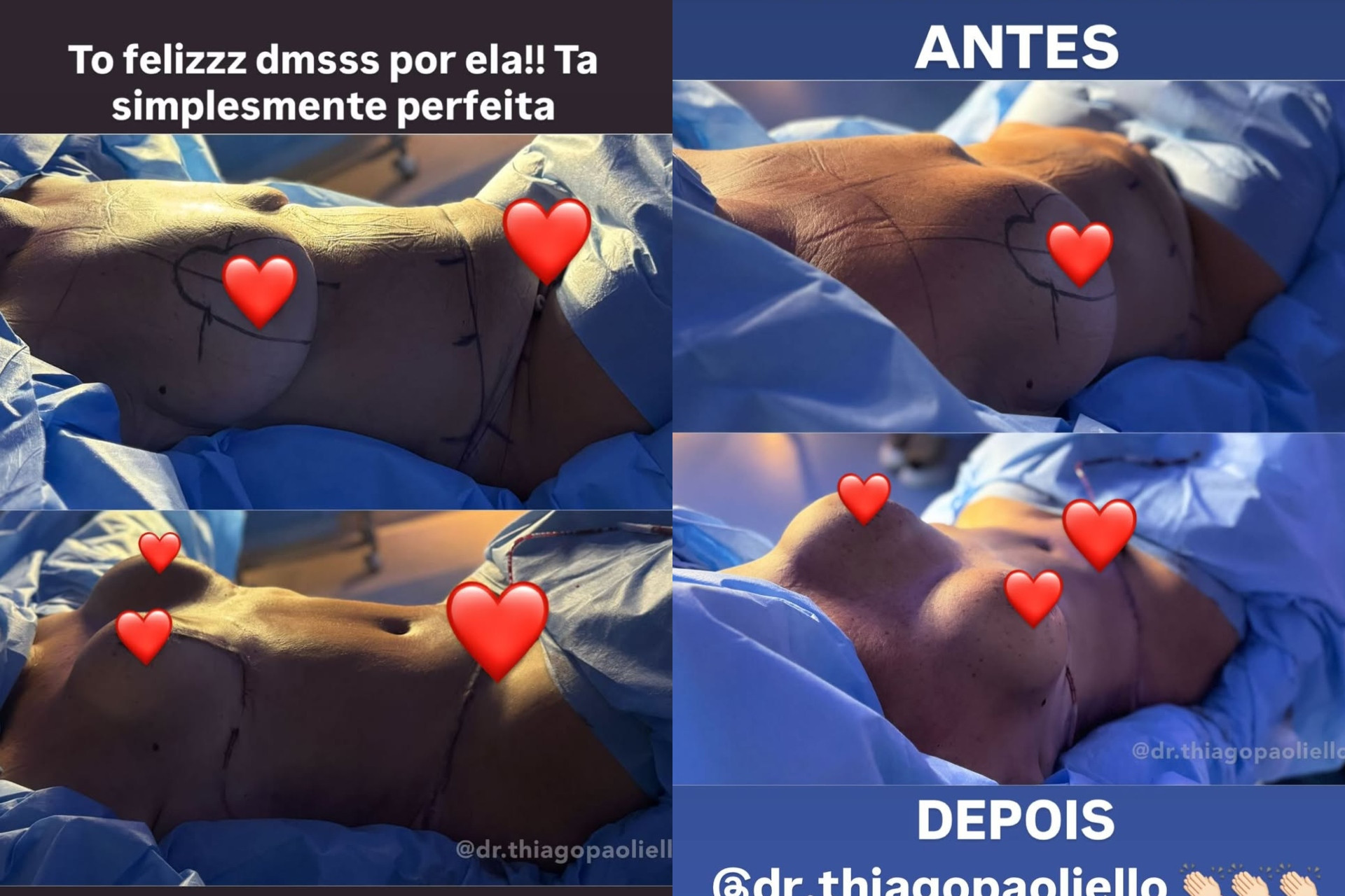 Virginia Fonseca mostra resultado de cirurgias plásticas da mãe, Margareth Serrão - Reprodução / Instagram