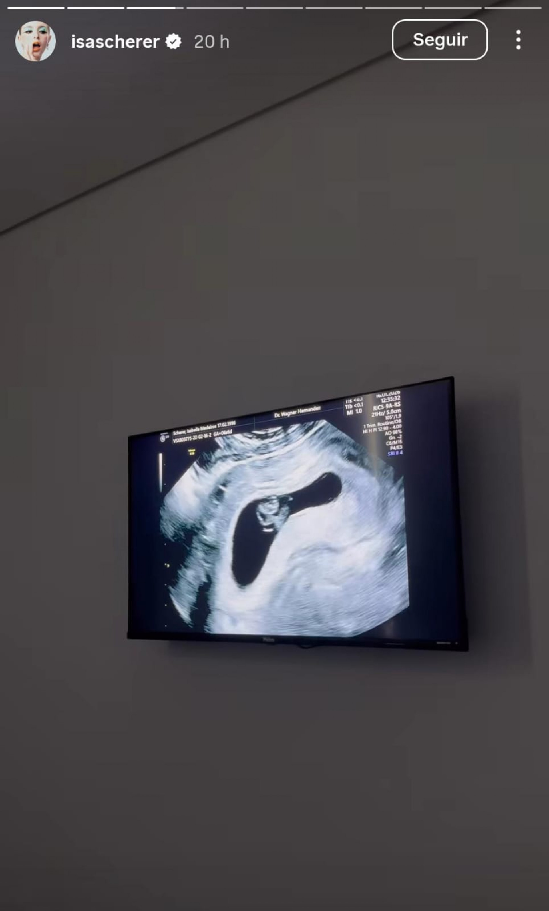 Grávida do terceiro filho, Isabella Scherer faz primeiro ultrassom - Reprodução de vídeo / Instagram