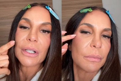 Ivete relata 'dormência' no lado esquerdo do rosto