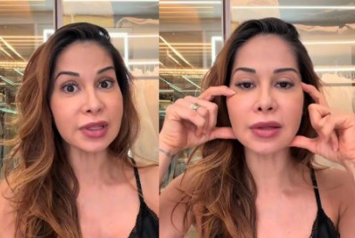 Maíra Cardi passará por cirurgia no rosto para retirada de PMMA