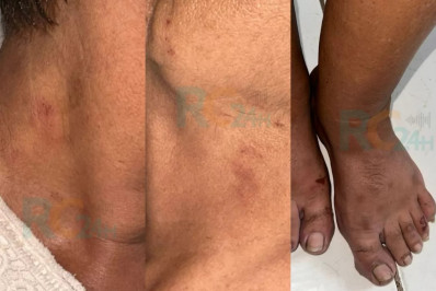 Idosa de 70 anos é estuprada após sair da UPA em Cabo Frio