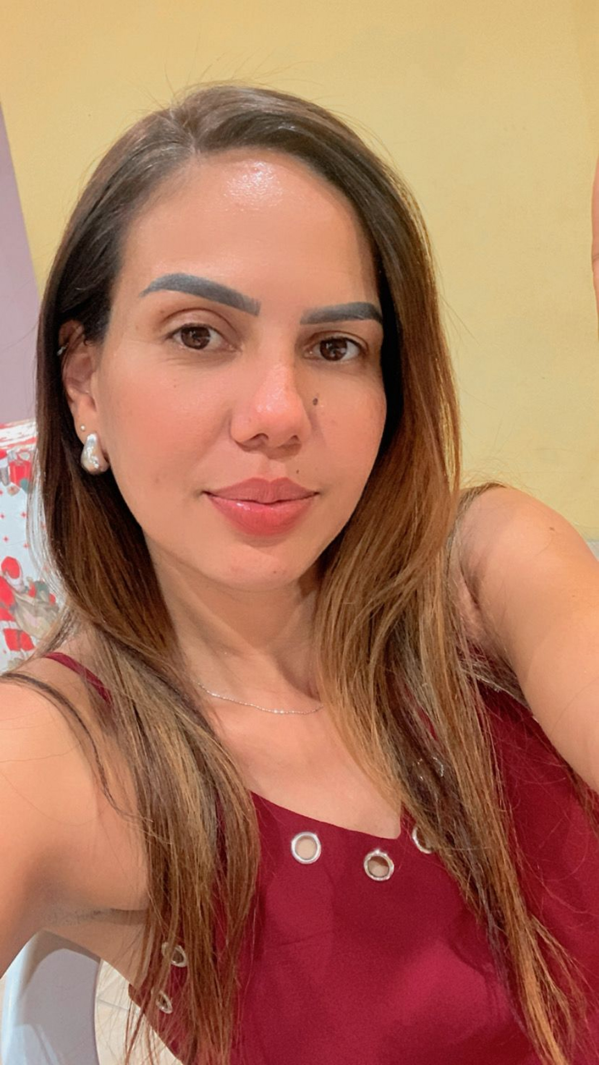 A nutricionista Camila Vieira sofreu muito até 'descobrir' a doença - Divulgação