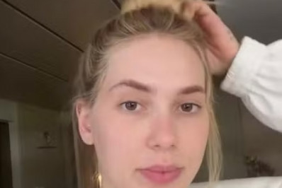 Virginia Fonseca relata crise de enxaqueca após atraso em tratamento