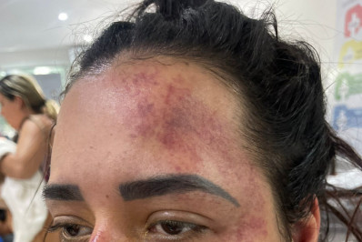 Mulher denuncia ex-companheiro após série de agressões em São Gonçalo: 'Ele pode me matar'