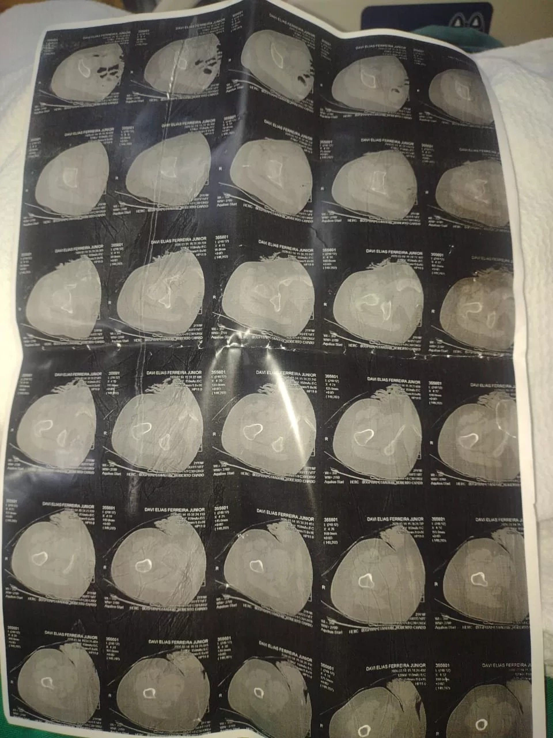 Caso levanta debate sobre segurança e acompanhamento nas escolas. - Reprodução/ G1