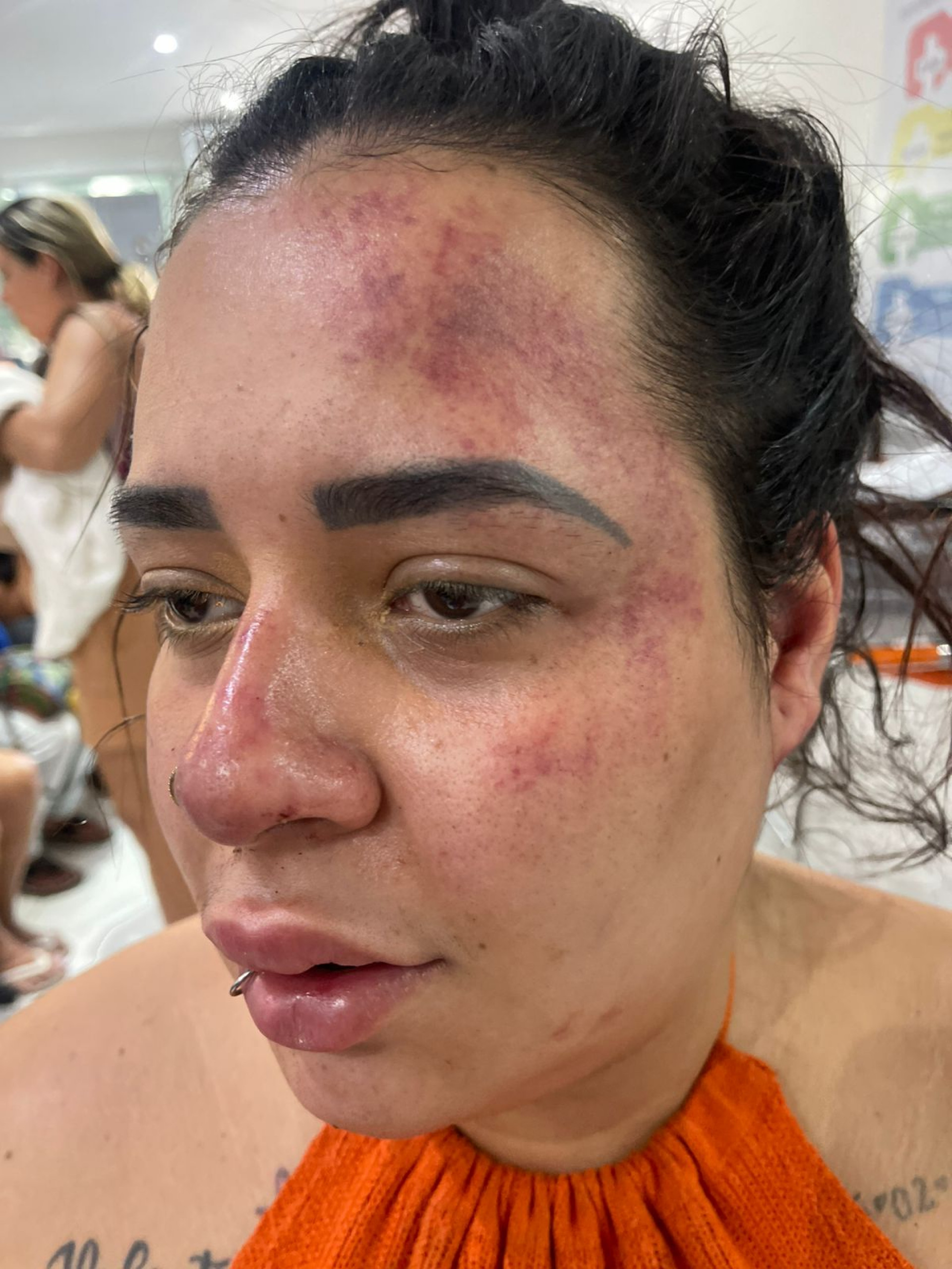 Mayara Coquito Lopes denuncia que foi agredida com socos e chutes pelo ex-companheiro, em São Gonçalo - Arquivo pessoal