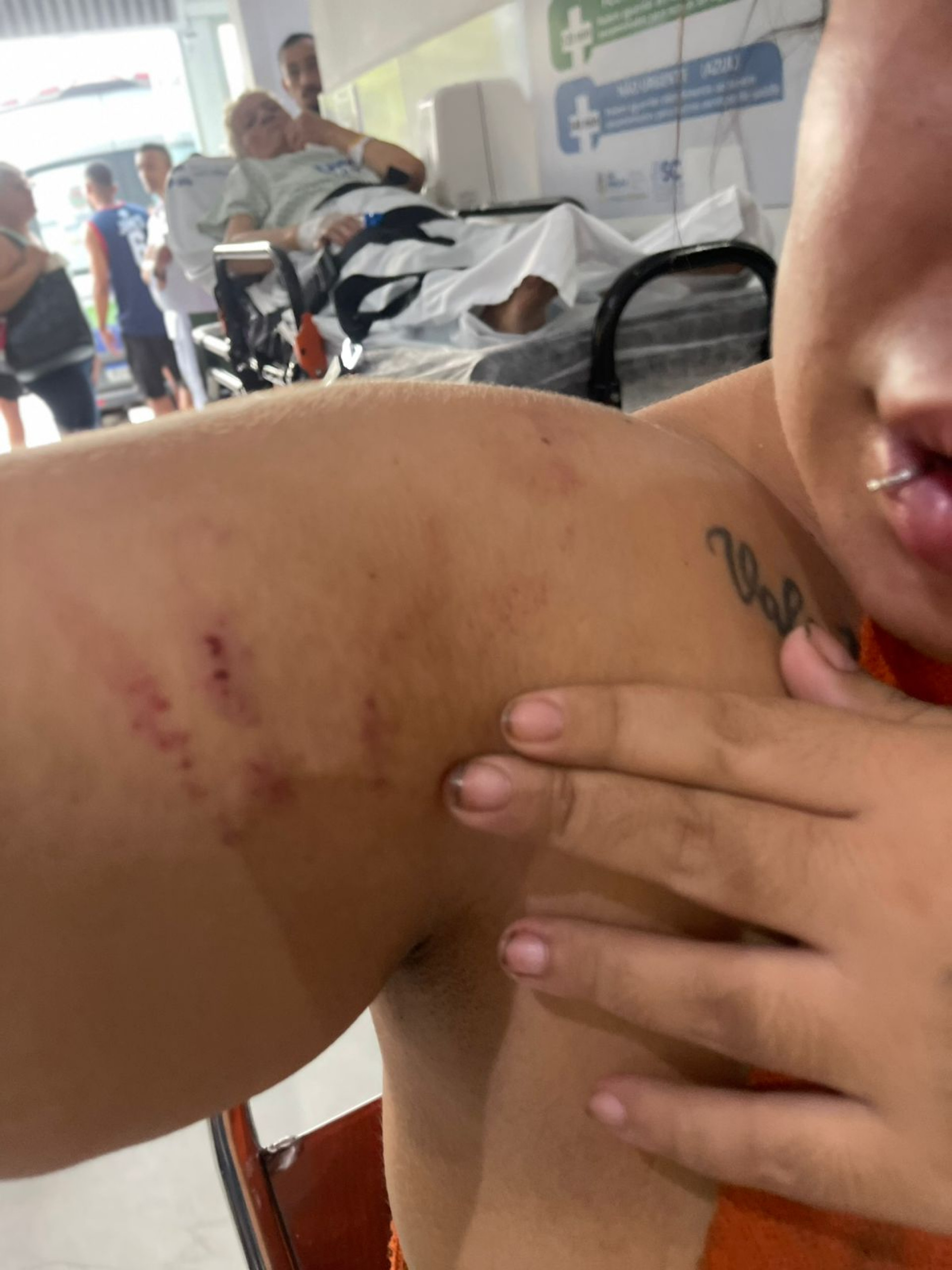 Mayara Coquito Lopes denuncia que foi agredida com socos e chutes pelo ex-companheiro, em São Gonçalo - Arquivo pessoal