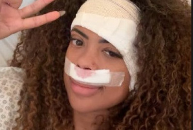 Cantora Marvvila passa por cirurgias e tranquiliza fãs 