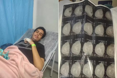 Jovem autista passa por cirurgia após fratura em escola de Cabo Frio