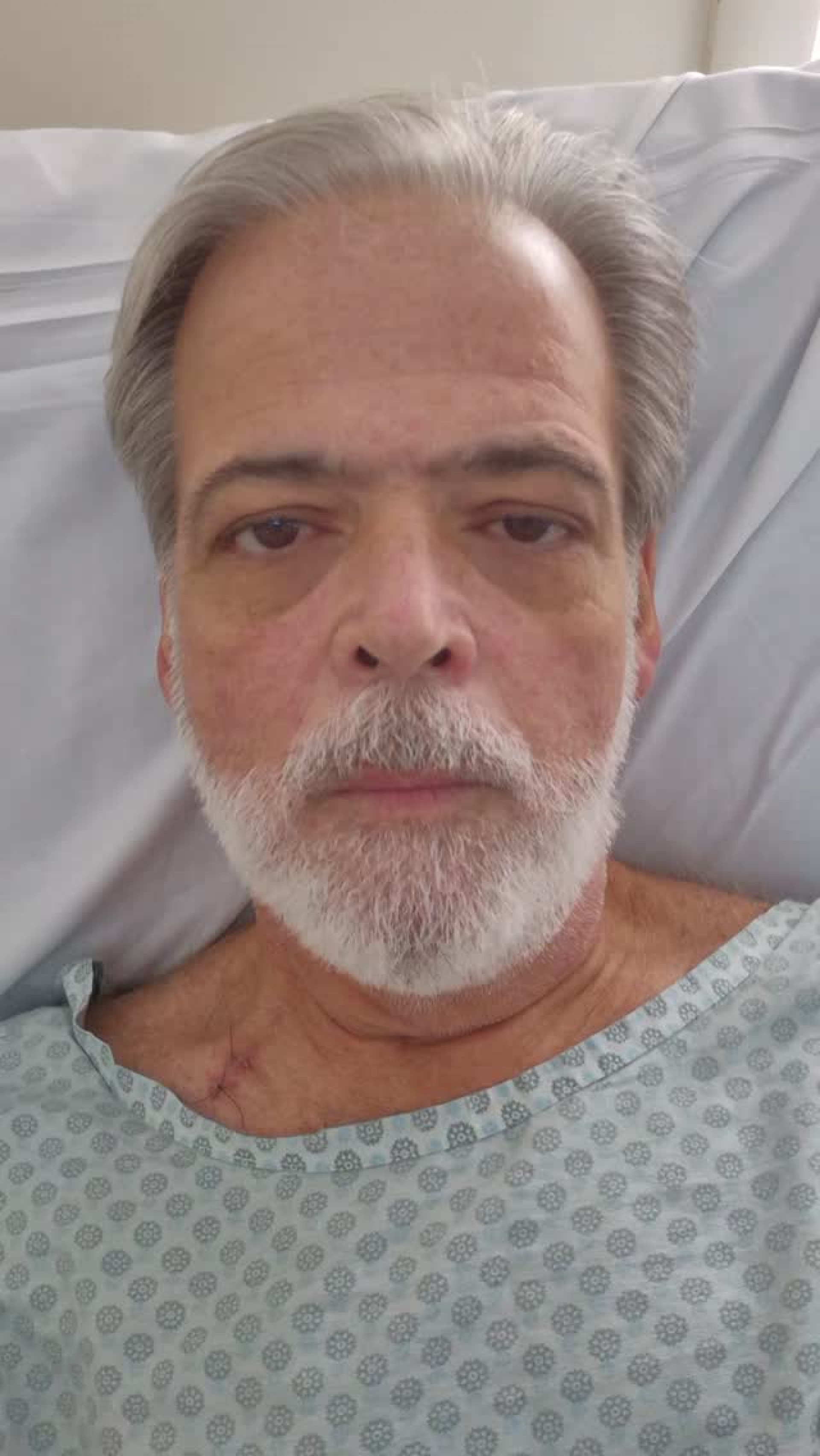 Claudio Cinti é internado no CTI após pneumonia e amigos pedem ajuda financeira