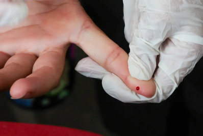 SUS passa a oferecer teste rápido de dengue