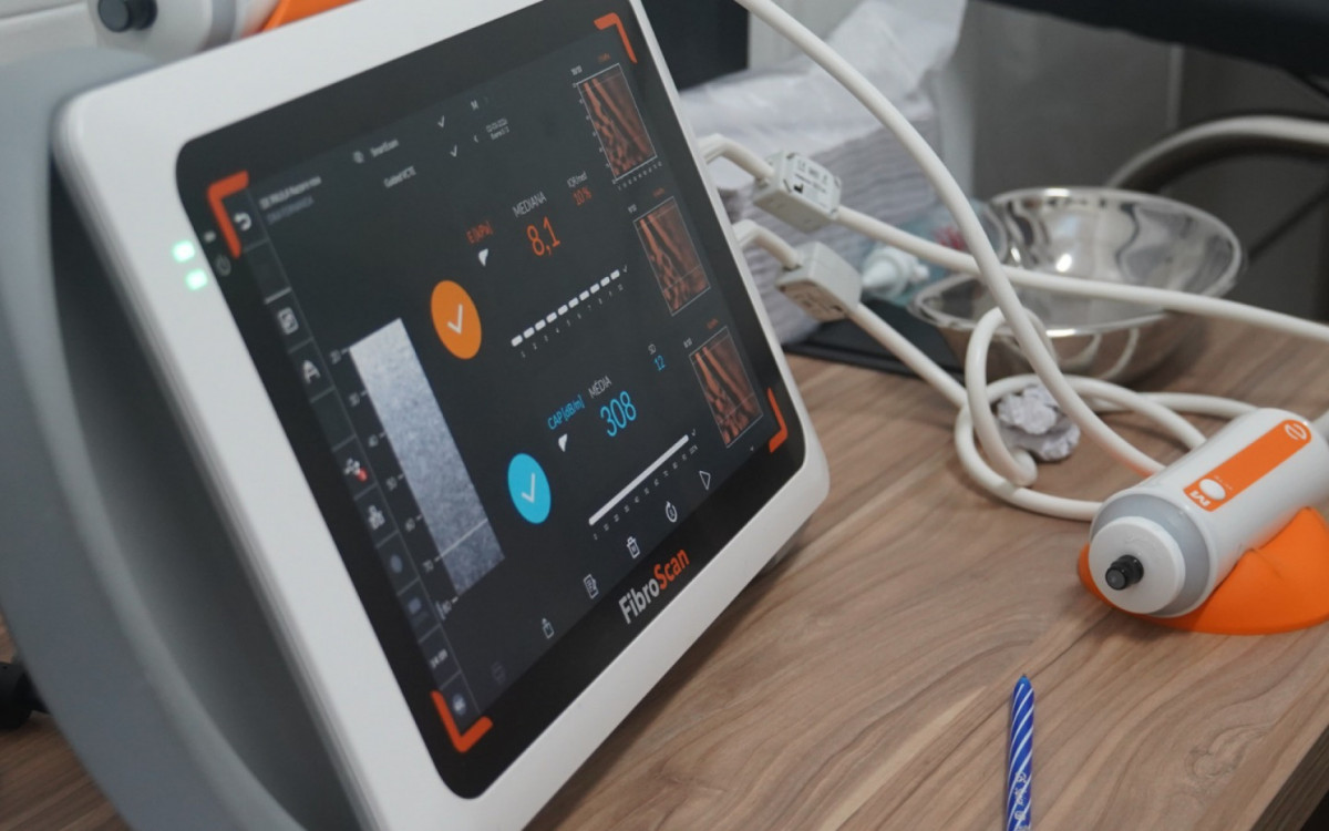 Rede estadual de saúde conta com o aparelho de elastografia hepática