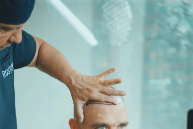 Diogo Nogueira revela novo transplante capilar e mostra resultado