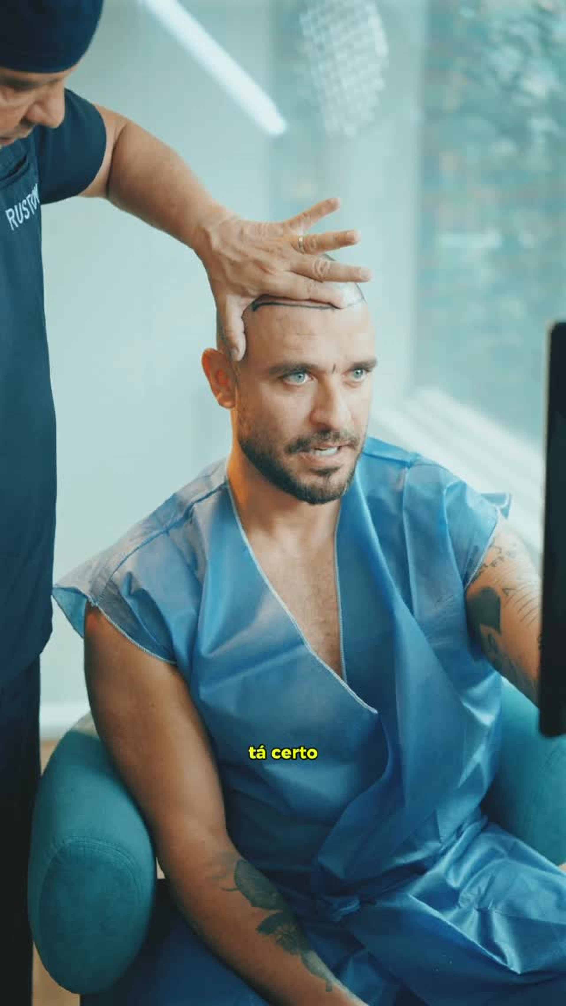 Diogo Nogueira revela novo transplante capilar e mostra resultado