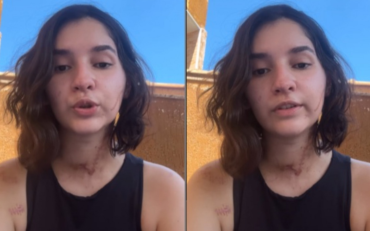 Alana Anísio Rosa, 20 anos, foi atacada dentro de casa em São Gonçalo