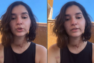 Vídeo: jovem que sobreviveu à tentativa de feminicídio relata ataque com mais de 15 facadas