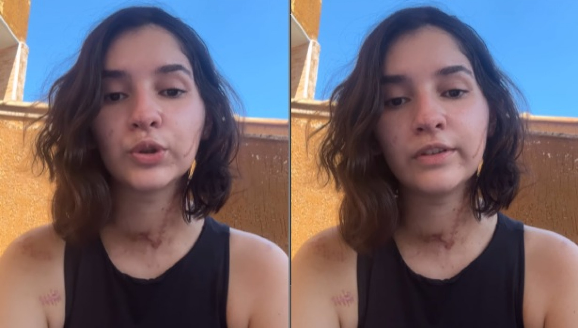 Alana An&iacute;sio Rosa, 20 anos, foi atacada dentro de casa em S&atilde;o Gon&ccedil;alo 