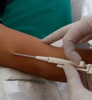 Prefeitura de Saquarema adota método contraceptivo Implanon na rede municipal de saúde