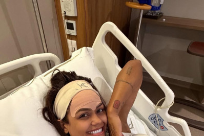 Camila Loures passa por cirurgia para remover veia da testa