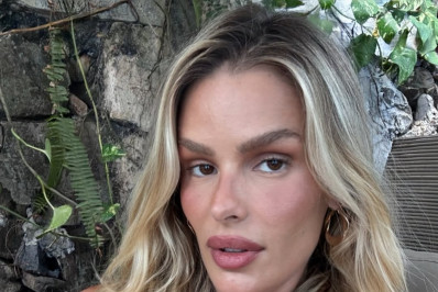 Yasmin Brunet mostra antes e depois após perder 25 kg e comemora: 'Lipedema desinflamado'