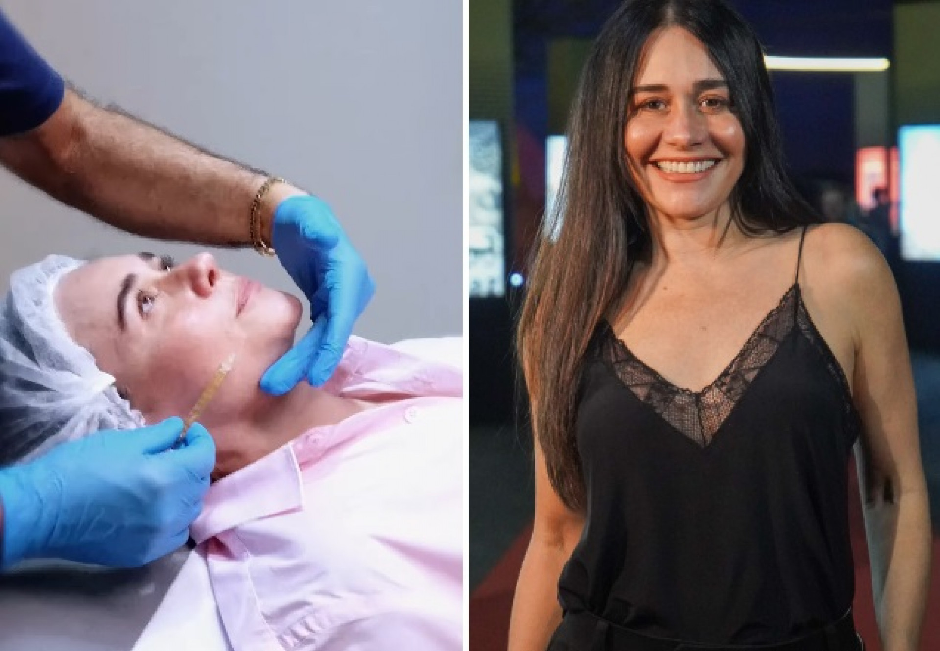 Alessandra Negrini faz procedimento com células-tronco e repercute entre fãs: 'A Substância'