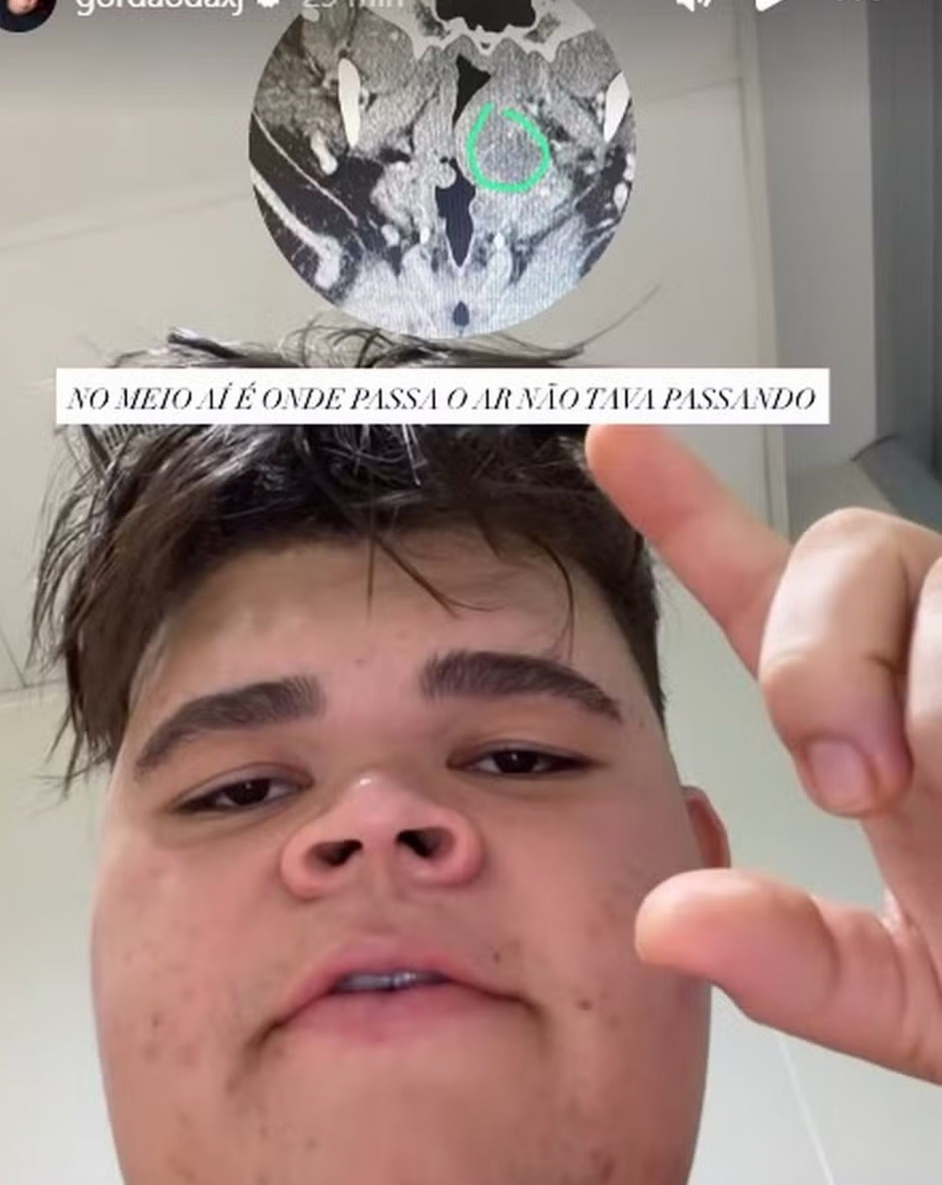 Gordão da XJ - Reprodução do Instagram