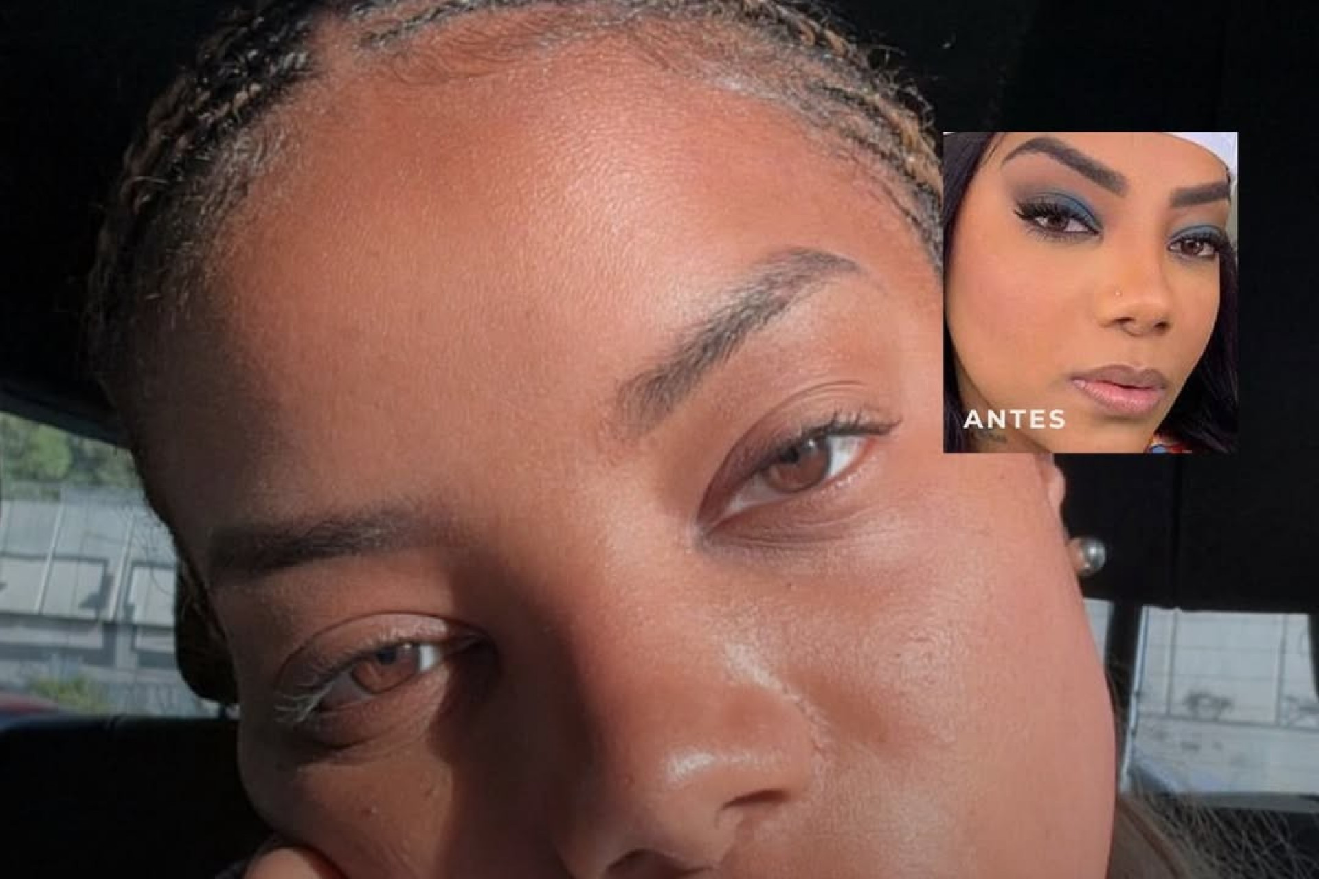 Ludmilla retirou a micropigmentação das sobrancelhas - Bruna Zanatta / Instagram