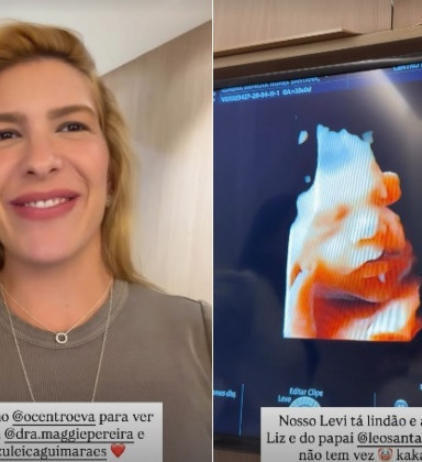 Lore Improta exibe rosto do filho em ultrassom: 'Lindão'