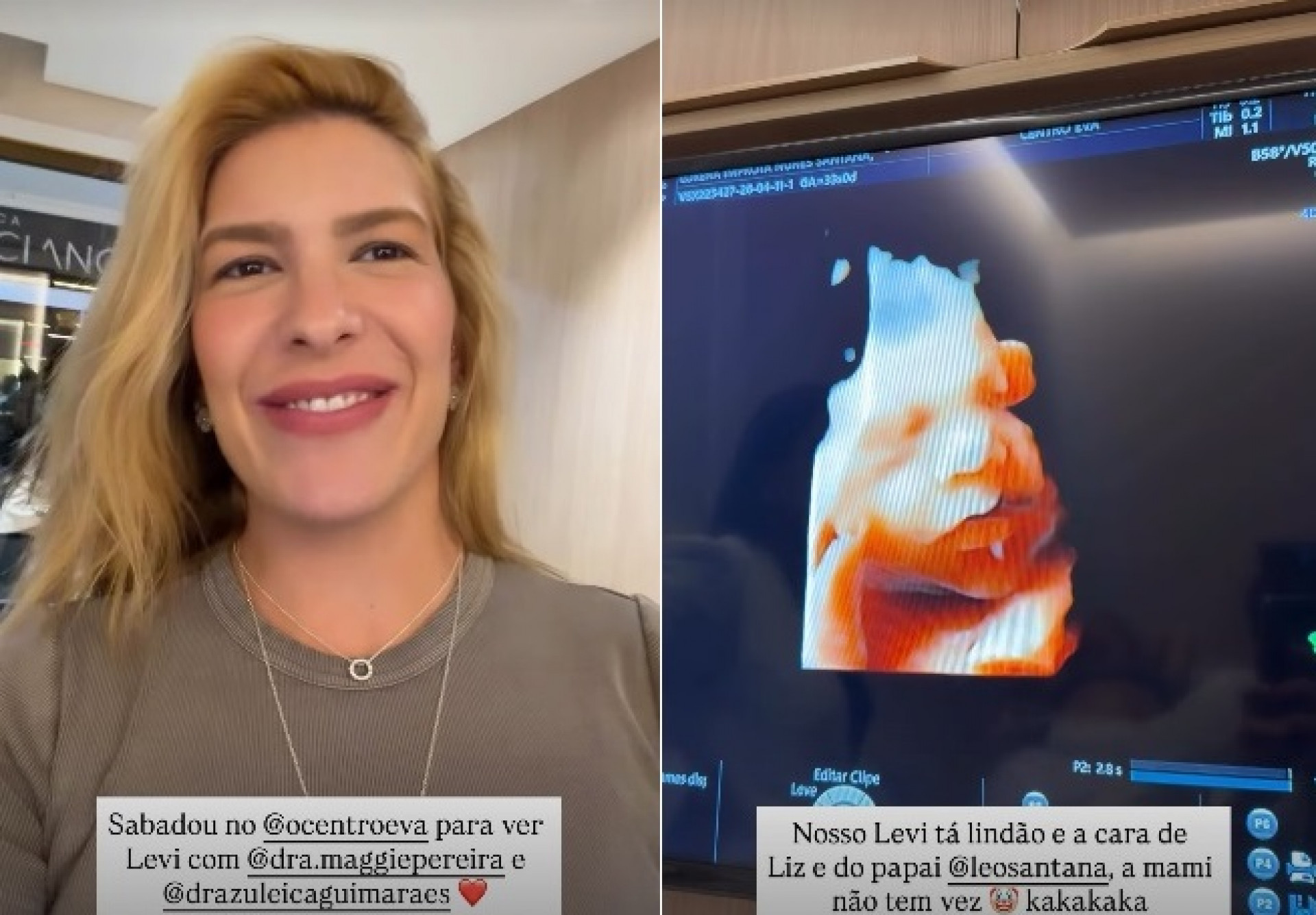 Lore Improta exibe rosto do filho em ultrassom: 'Lindão'