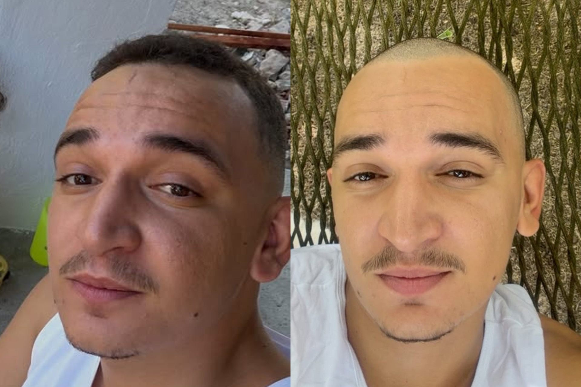 João Gomes aparece de cabeça raspada - Reprodução / Instagram