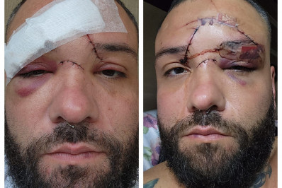 Polícia investiga agressão contra designer em Mesquita; vítima alega homofobia