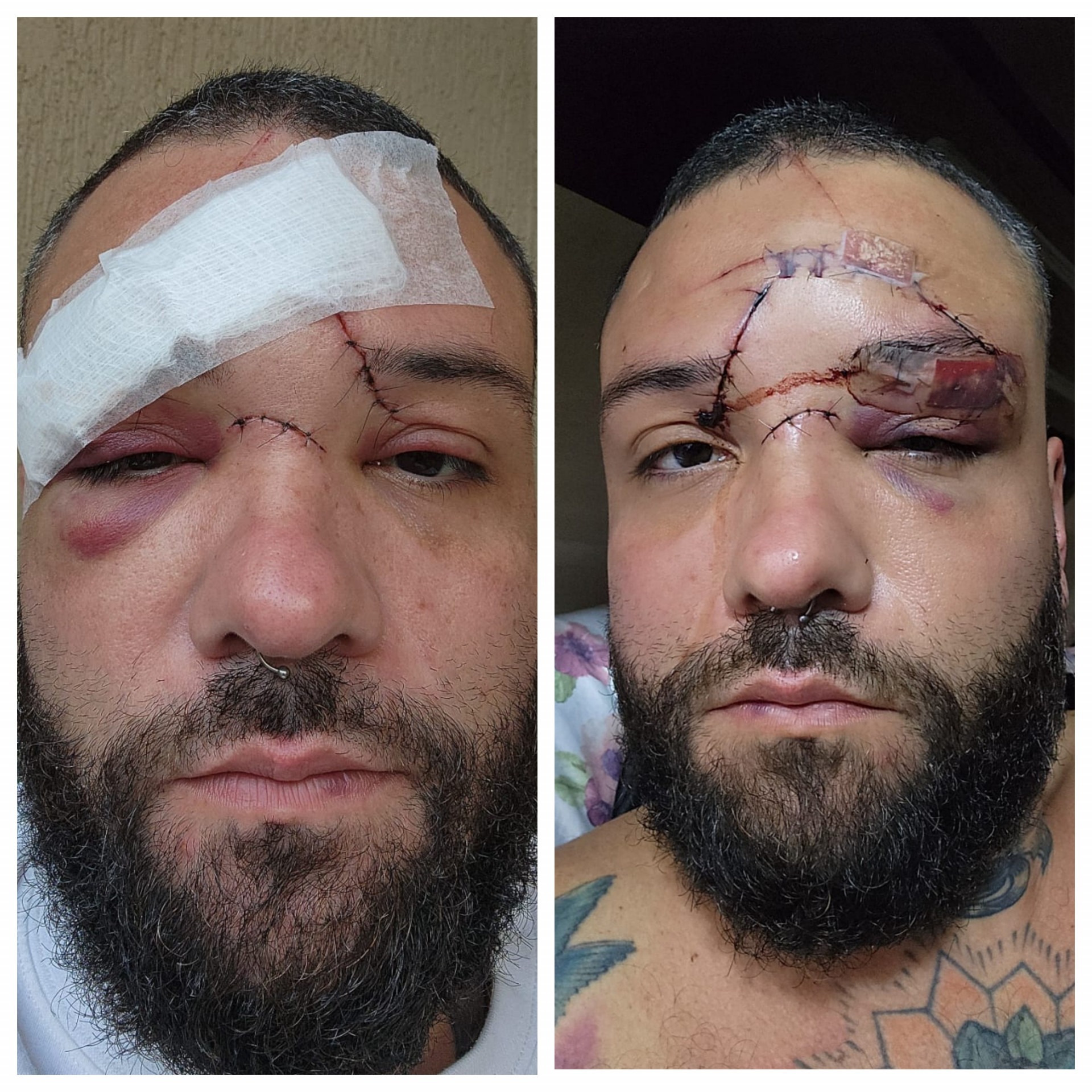 Michel Cardoso teve diversos cortes no rosto