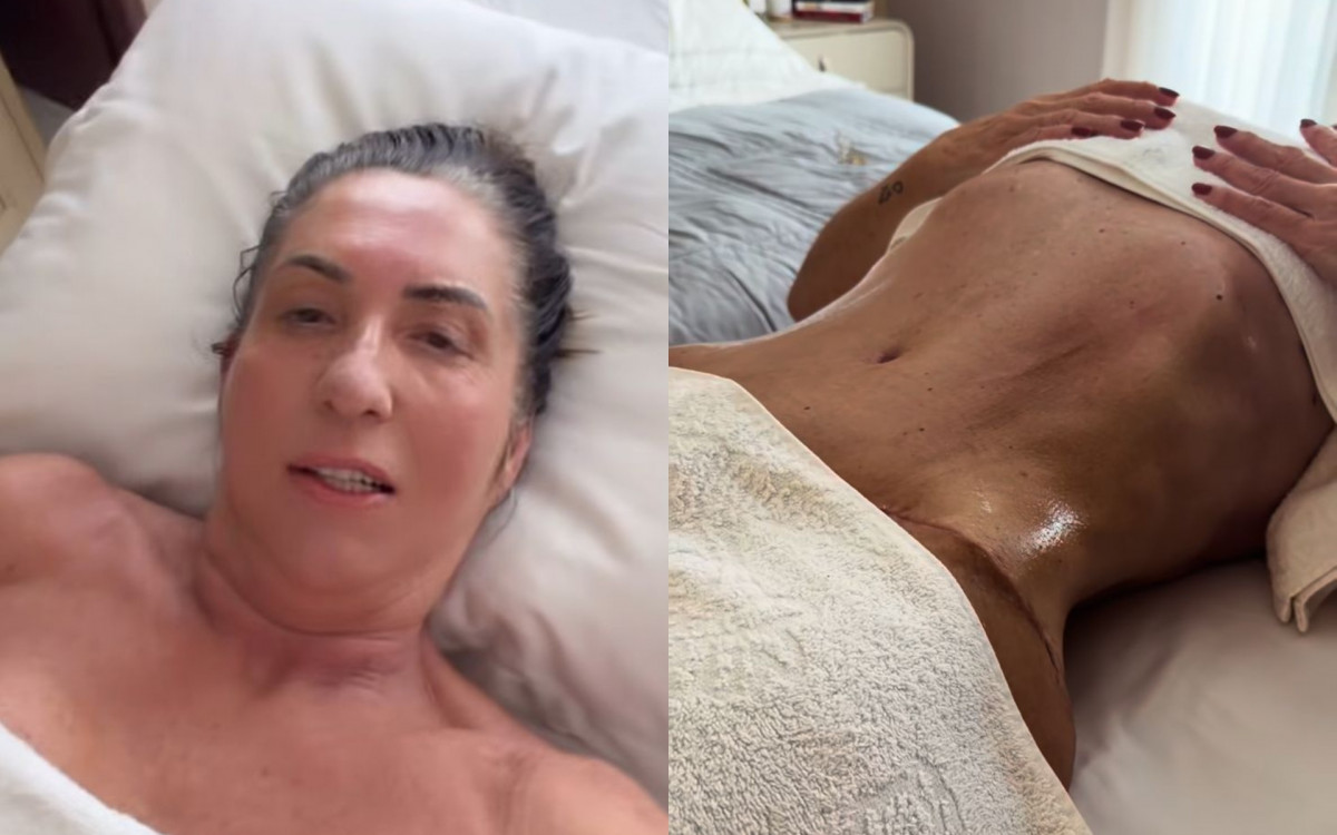 Margareth Serr&atilde;o, m&atilde;e de Virginia, impressiona com resultado de cirurgia pl&aacute;stica