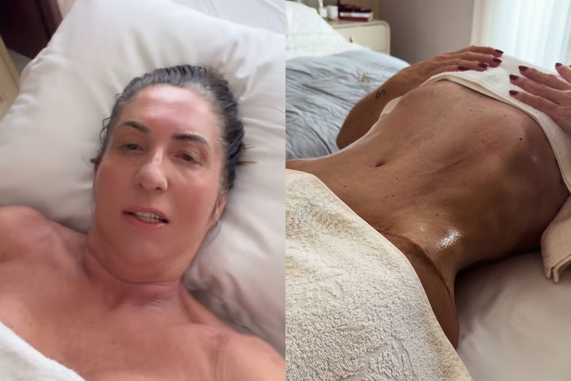 Margareth Serrão, mãe de Virginia, impressiona com resultado de cirurgia plástica - Reprodução / Instagram